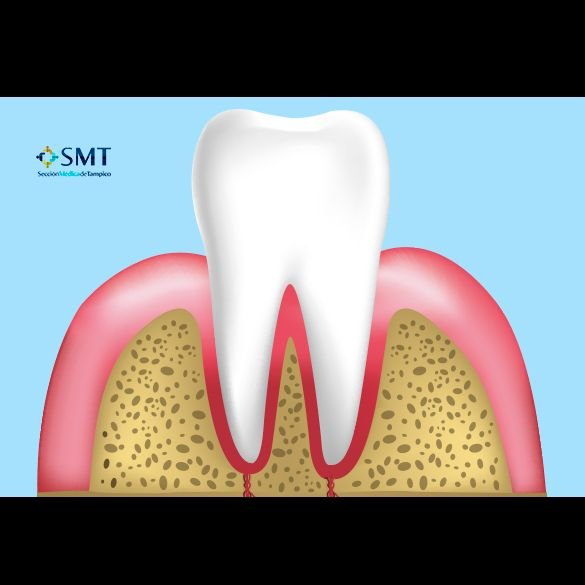 Periodoncistas en Tampico